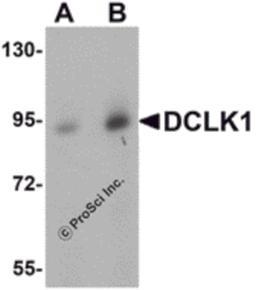 Western blot analysis of DCLK1 in human brain tissue lysate with DCLK1 antibody at (A) 0.5 and (B) 1 μg/mL.