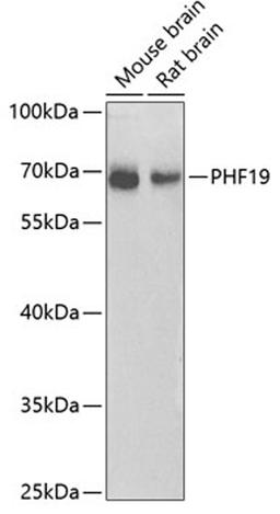 Western blot - PHF19 antibody (A8065)