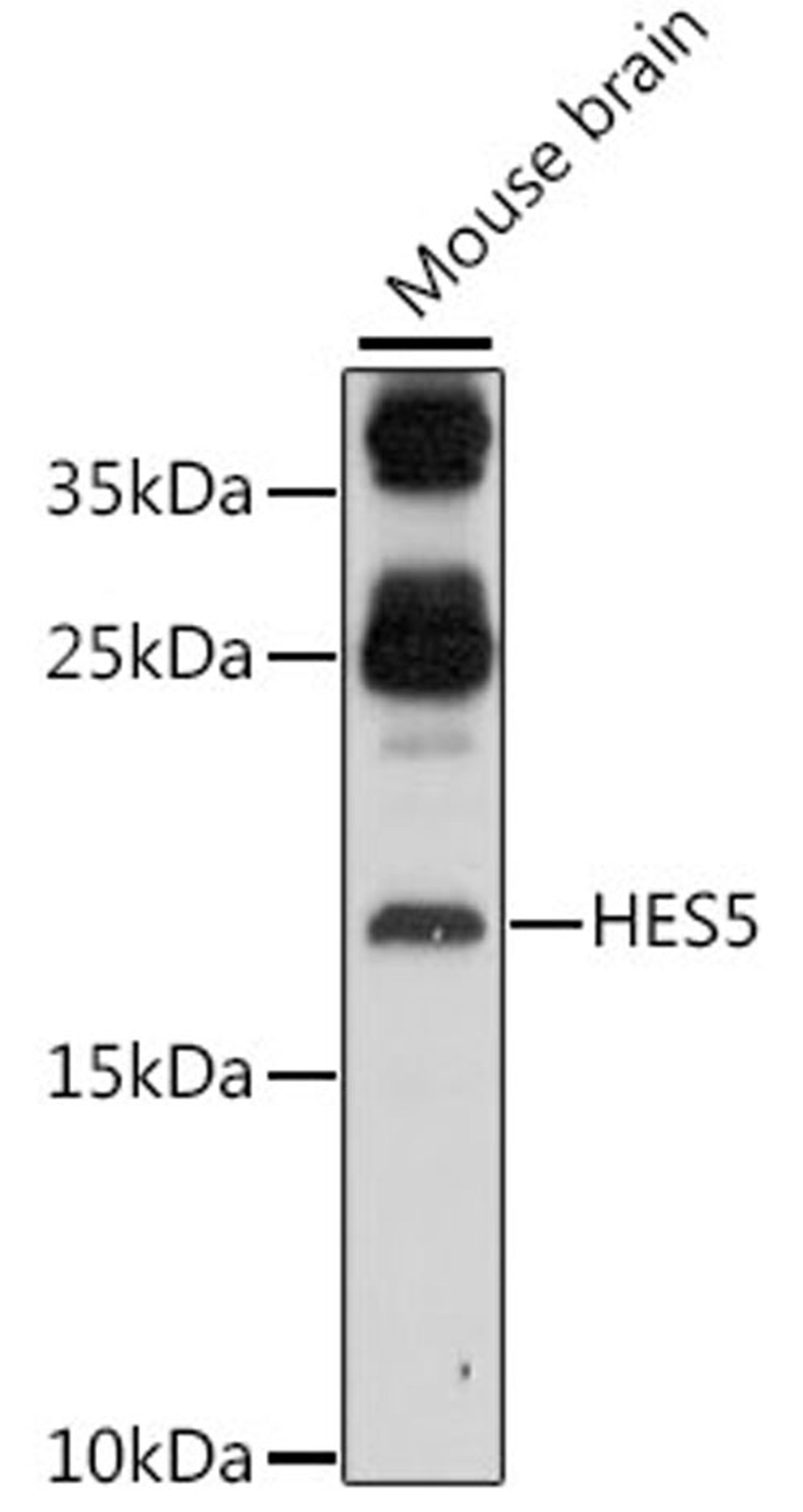 Western blot - HES5 antibody (A16237)