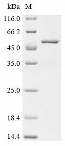 (Tris-Glycine gel) Discontinuous SDS-PAGE (reduced) with 5% enrichment gel and 15% separation gel.