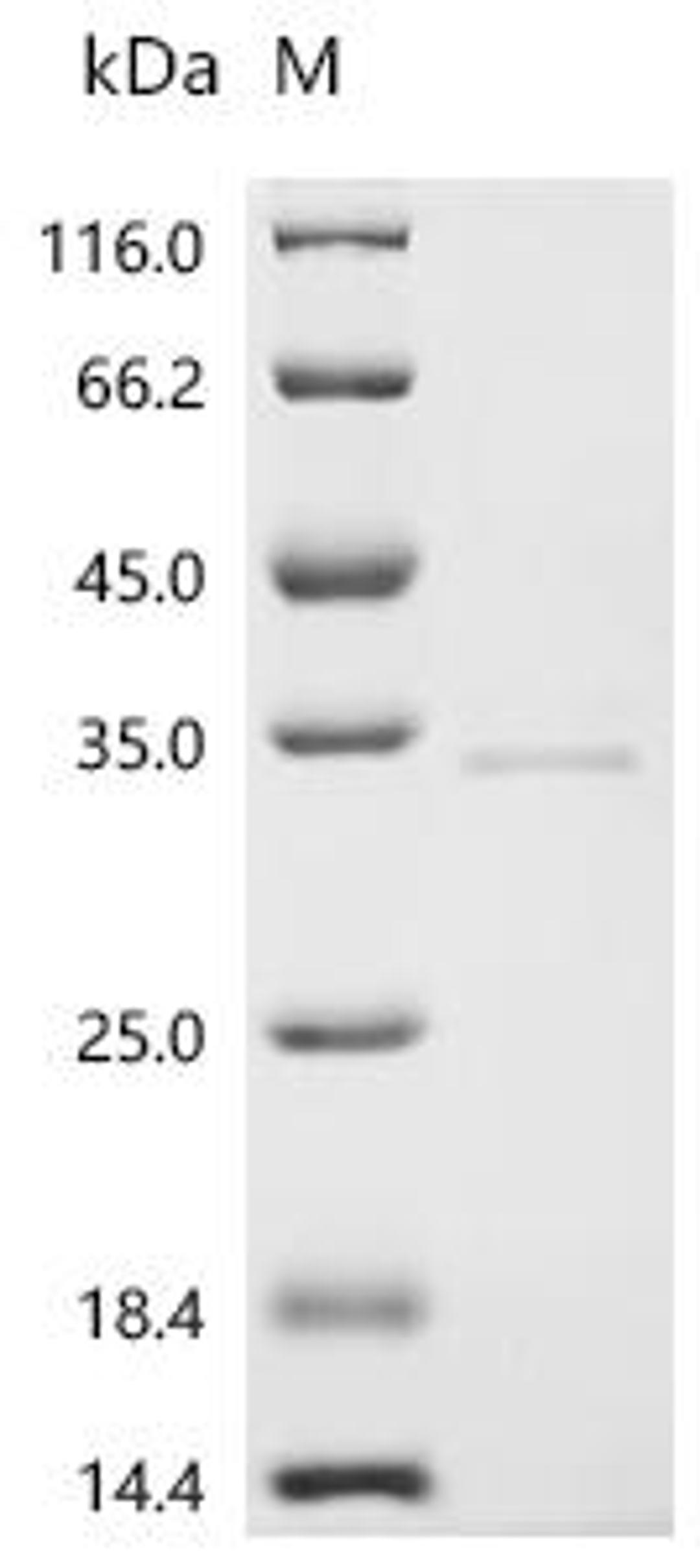 (Tris-Glycine gel) Discontinuous SDS-PAGE (reduced) with 5% enrichment gel and 15% separation gel.