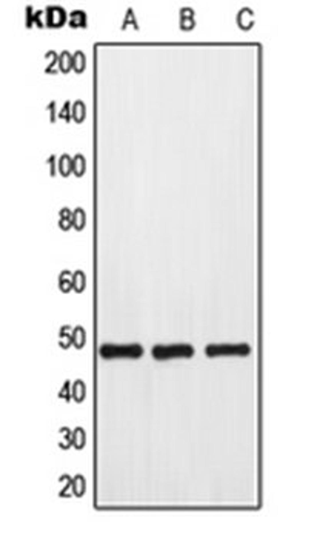 Western blot analysis of HeLa (Lane 1), mouse kidney (Lane 2), rat kidney (Lane 3) whole cell lysates using GPR173 antibody