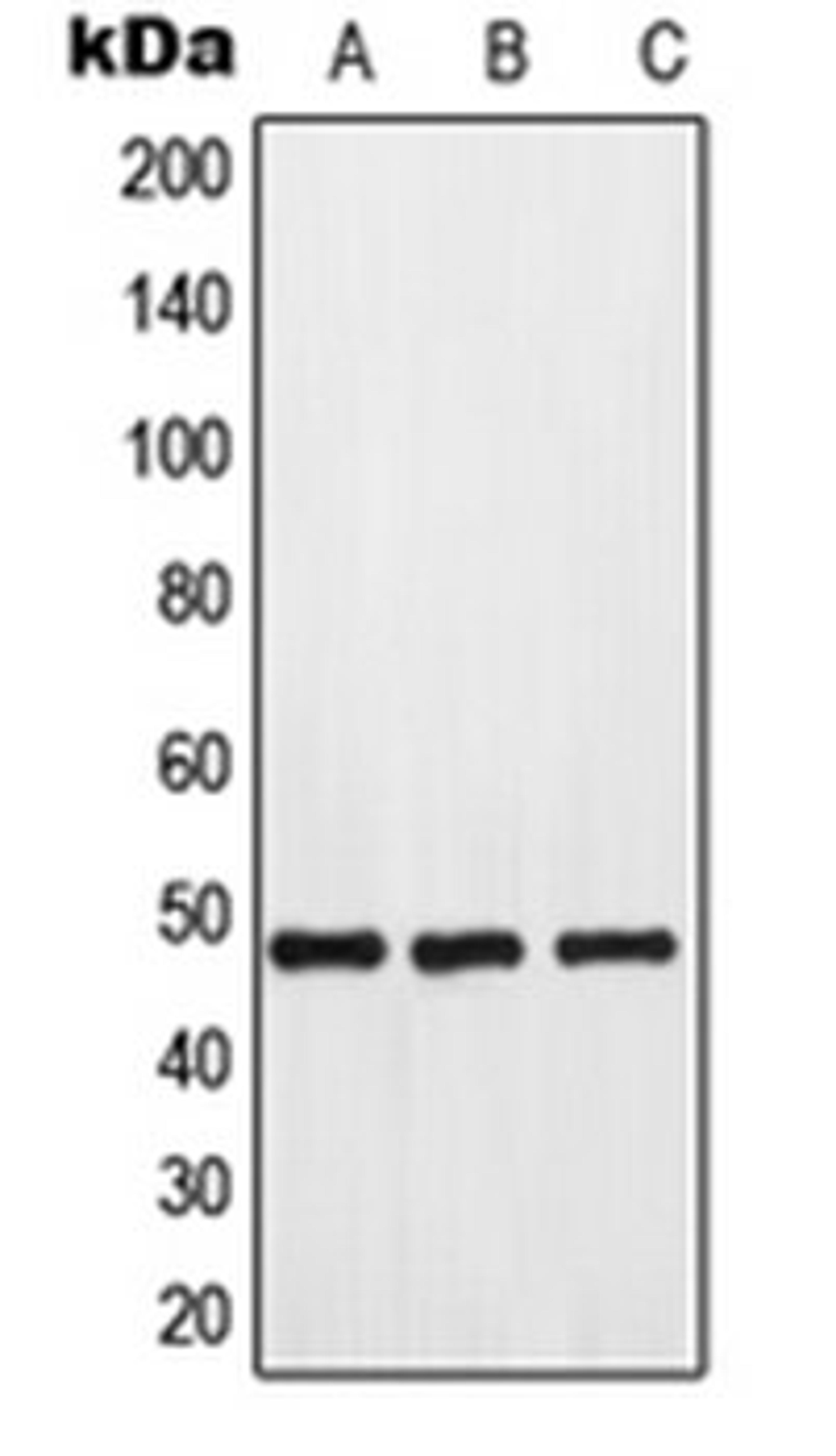 Western blot analysis of HeLa (Lane 1), mouse kidney (Lane 2), rat kidney (Lane 3) whole cell lysates using GPR173 antibody