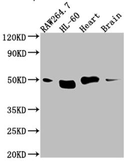 Western Blot. Positive WB detected in: RAW264.7 whole cell lysate, HL-60 whole cell lysate, Mouse Herat whole cell lysate, Mouse Brain whole cell lysate. All lanes: Tin2 antibody at 1:1000. Secondary. Goat polyclonal to rabbit IgG at 1/50000 dilution. Predicted band size: 51, 40, 16 kDa. Observed band size: 51 kDa.