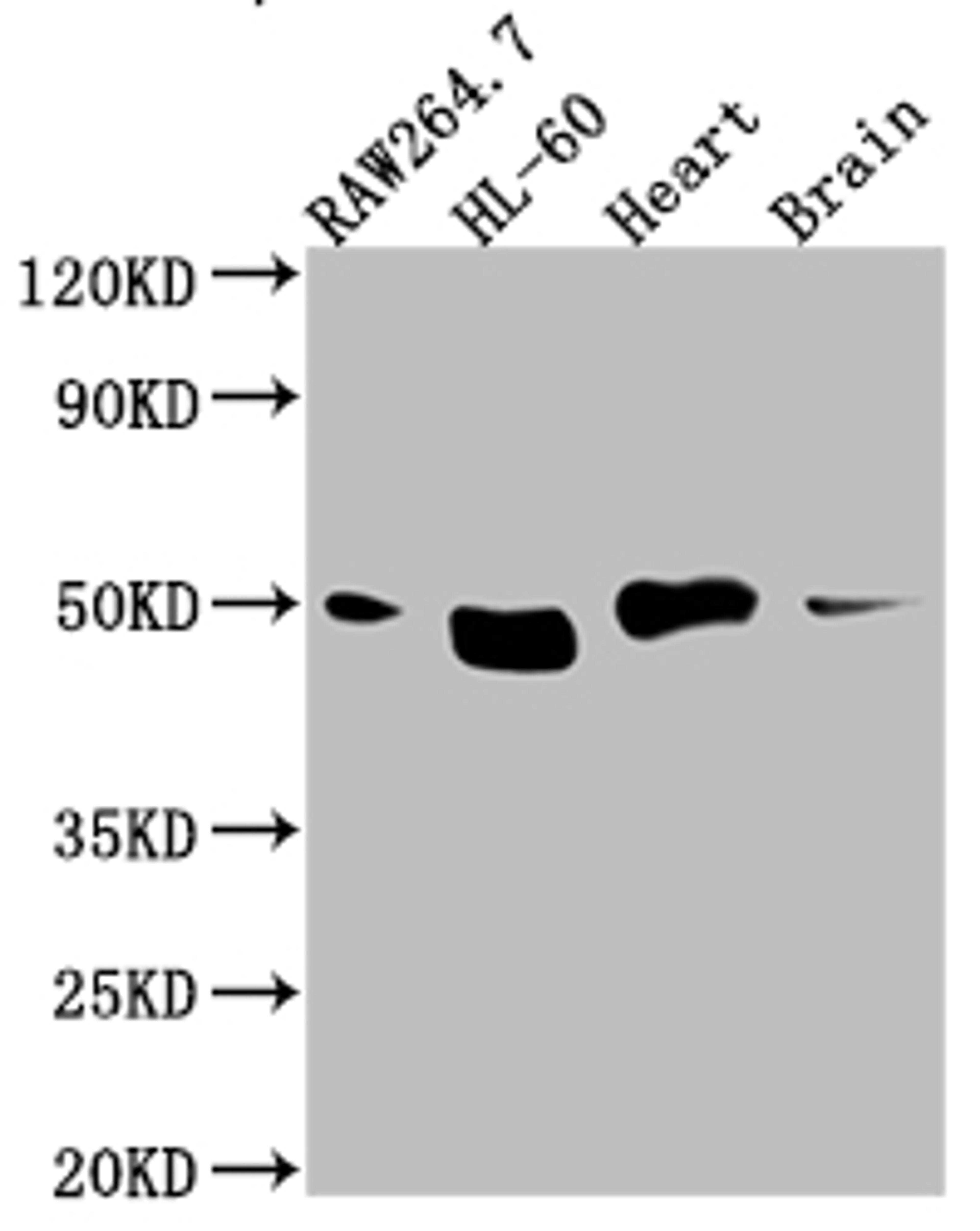 Western Blot. Positive WB detected in: RAW264.7 whole cell lysate, HL-60 whole cell lysate, Mouse Herat whole cell lysate, Mouse Brain whole cell lysate. All lanes: Tin2 antibody at 1:1000. Secondary. Goat polyclonal to rabbit IgG at 1/50000 dilution. Predicted band size: 51, 40, 16 kDa. Observed band size: 51 kDa.