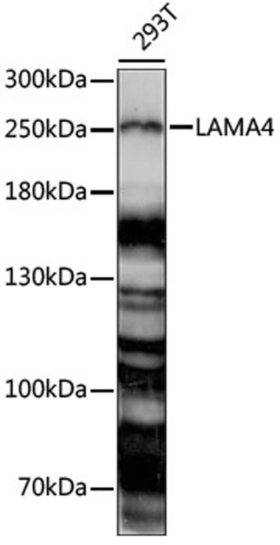 Western blot - LAMA4 antibody (A15286)