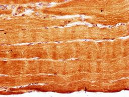 IHC image of CSB-PA020621LA01HU diluted at 1:300 and staining in paraffin-embedded human skeletal muscle tissue performed on a Leica BondTM system. After dewaxing and hydration, antigen retrieval was mediated by high pressure in a citrate buffer (pH 6.0). Section was blocked with 10% normal goat serum 30min at RT. Then primary antibody (1% BSA) was incubated at 4°C overnight. The primary is detected by a biotinylated secondary antibody and visualized using an HRP conjugated SP system.