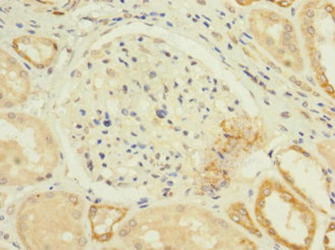 Immunohistochemistry of paraffin-embedded human kidney tissue using CSB-PA004404ESR1HU at dilution of 1:100