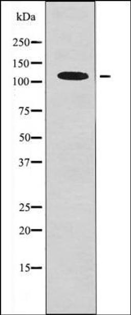 Western blot analysis of 293 whole cell lysates using EPH B1/3/4 -Phospho-Tyr778/792/774- antibody