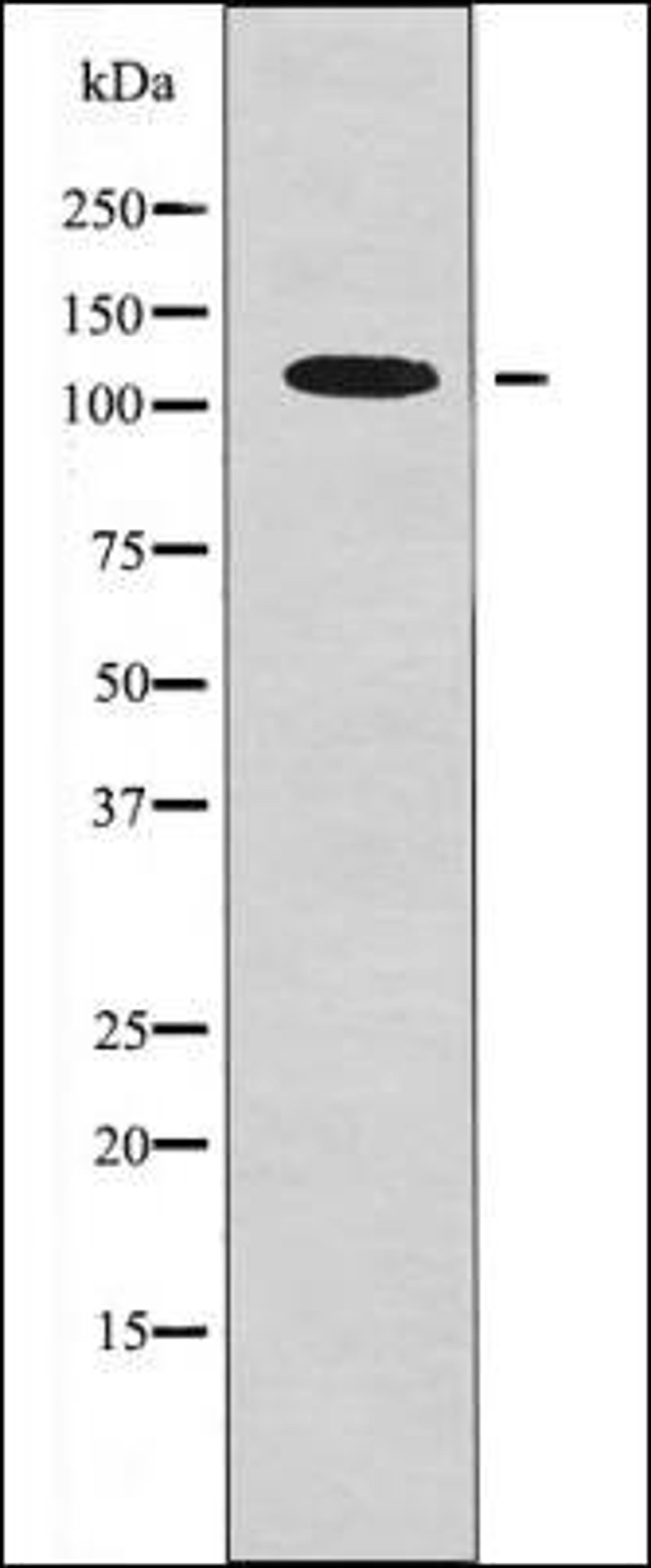 Western blot analysis of 293 whole cell lysates using EPH B1/3/4 -Phospho-Tyr778/792/774- antibody