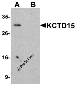Western blot analysis of KCTD15 in HeLa cell lysate with KCTD15 antibody at 1μg/ml in (A) the absence and (B) the presence of blocking buffer.