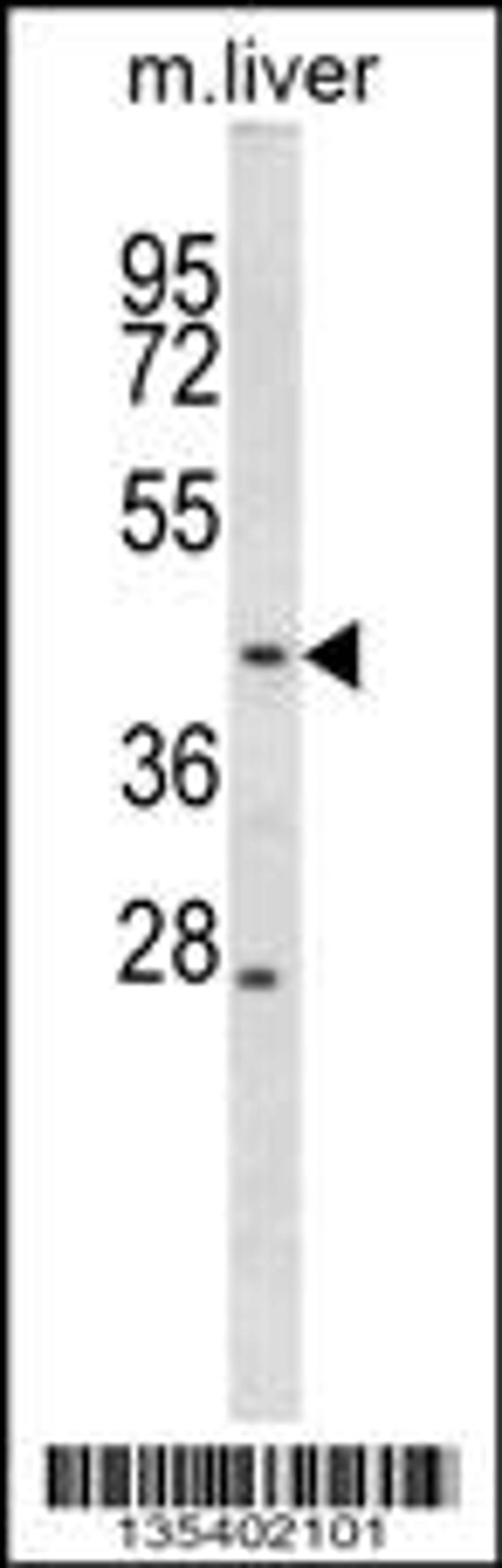 Western blot analysis in mouse liver tissue lysates (35ug/lane).