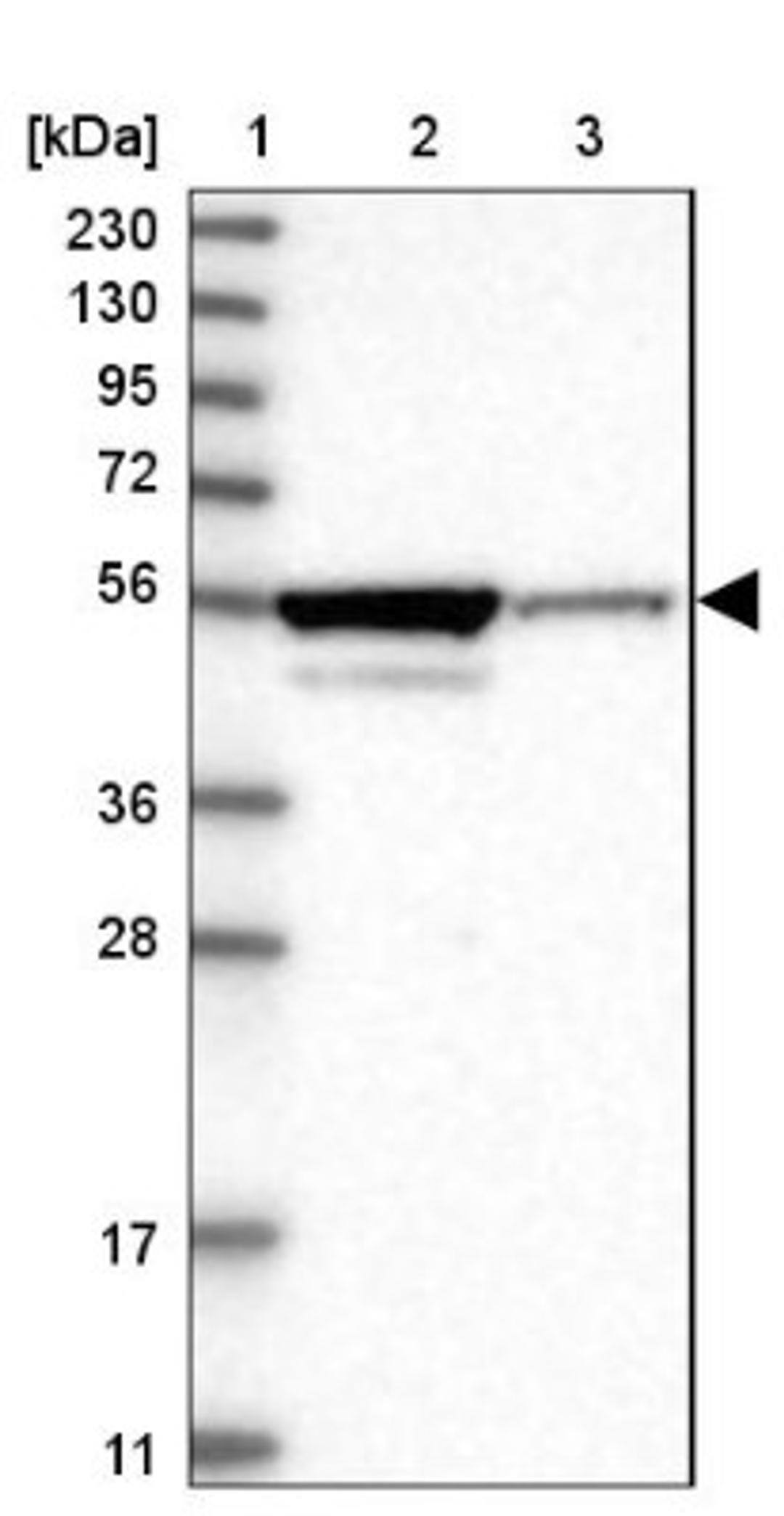 Western Blot: ZNF614 Antibody [NBP1-82133] - Lane 1: Marker [kDa] 230, 130, 95, 72, 56, 36, 28, 17, 11<br/>Lane 2: Human cell line RT-4<br/>Lane 3: Human cell line U-251MG sp