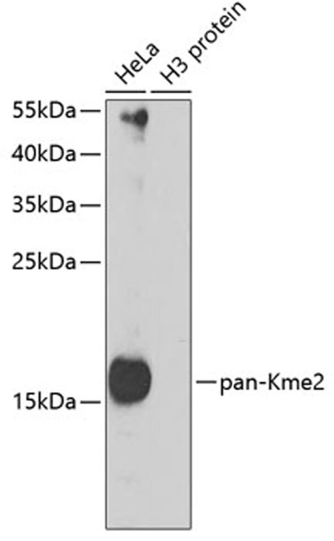 Western blot - pan-Kme2 antibody (A5870)