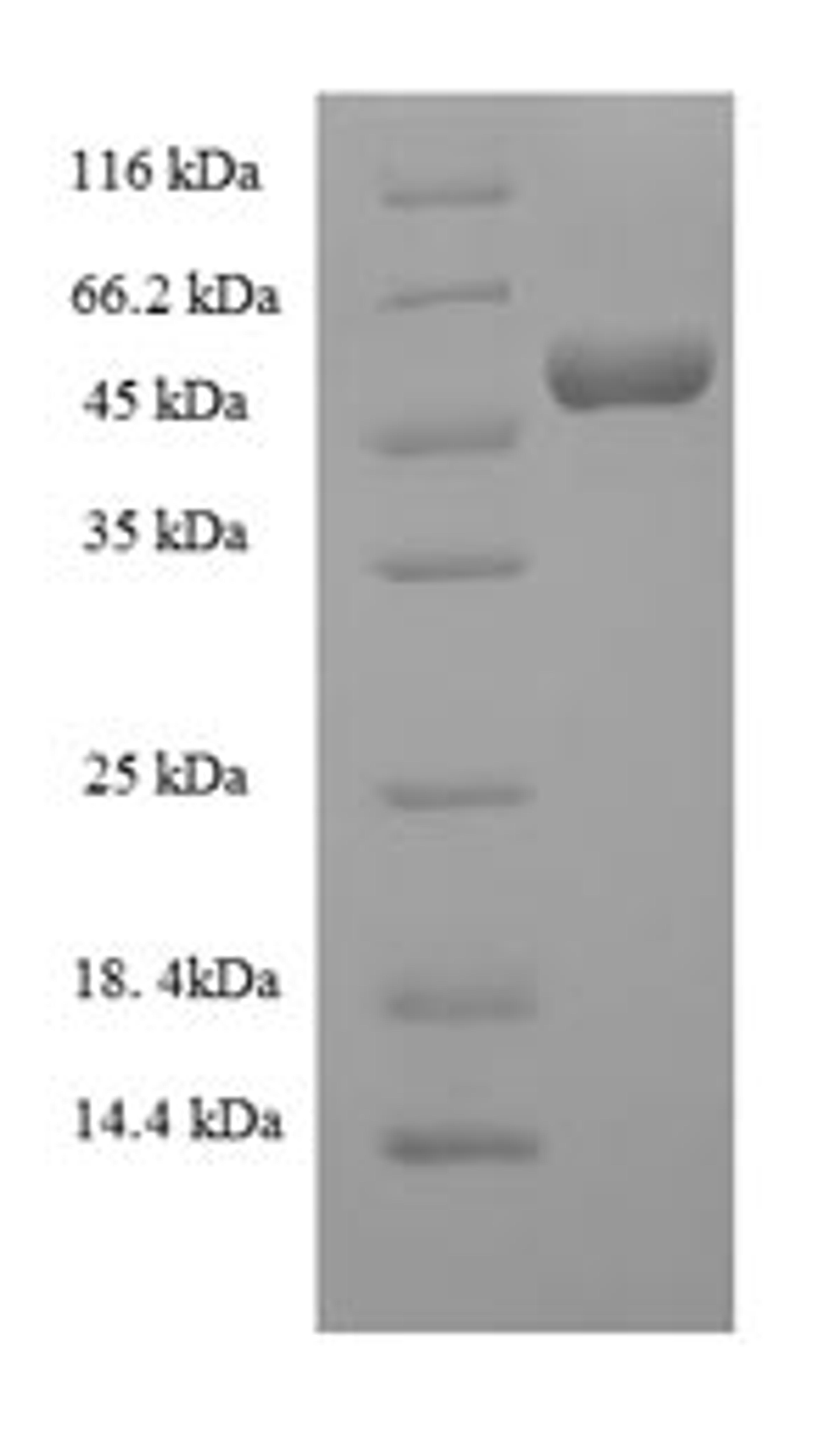 (Tris-Glycine gel) Discontinuous SDS-PAGE (reduced) with 5% enrichment gel and 15% separation gel.