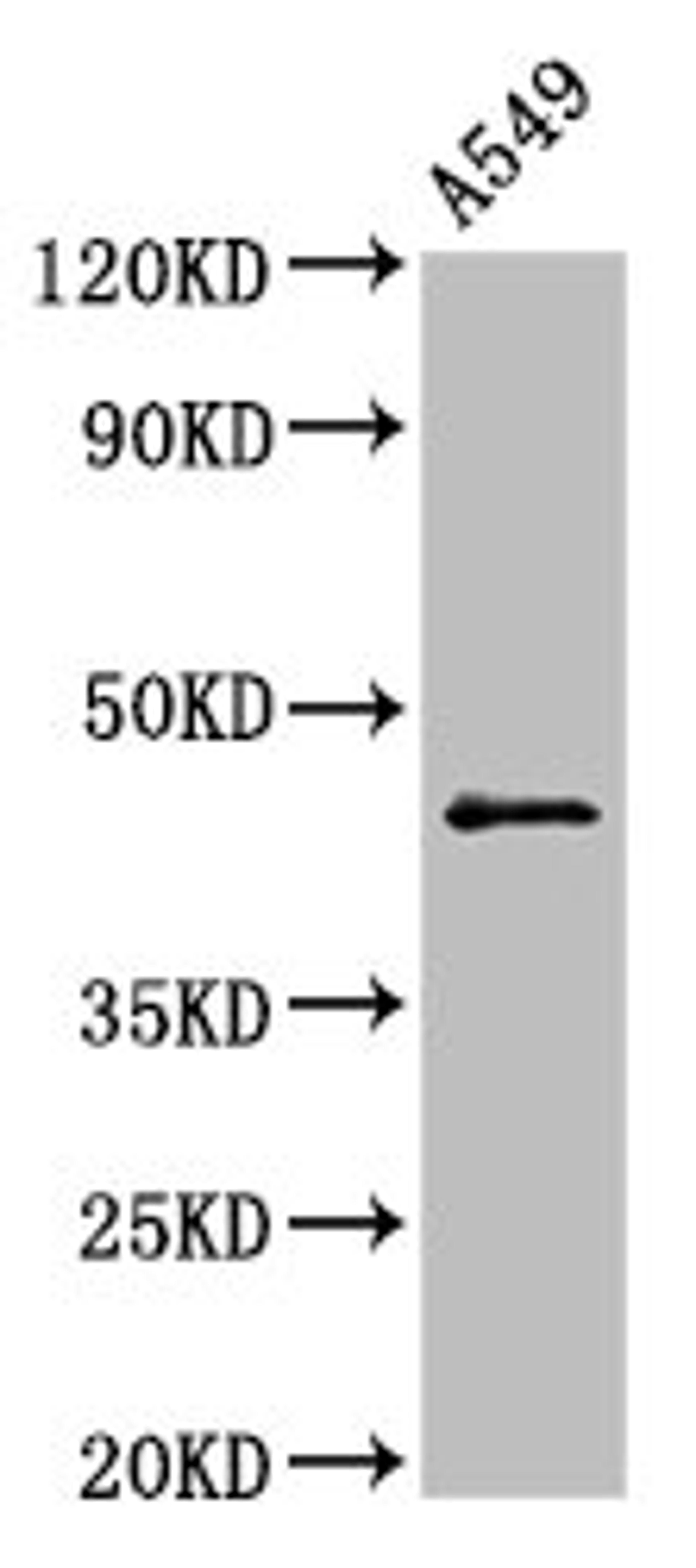 Western Blot. Positive WB detected in: A549 whole cell lysate. All lanes: CCNB2 antibody at 2.5µg/ml. Secondary. Goat polyclonal to rabbit IgG at 1/50000 dilution. Predicted band size: 46 kDa. Observed band size: 46 kDa