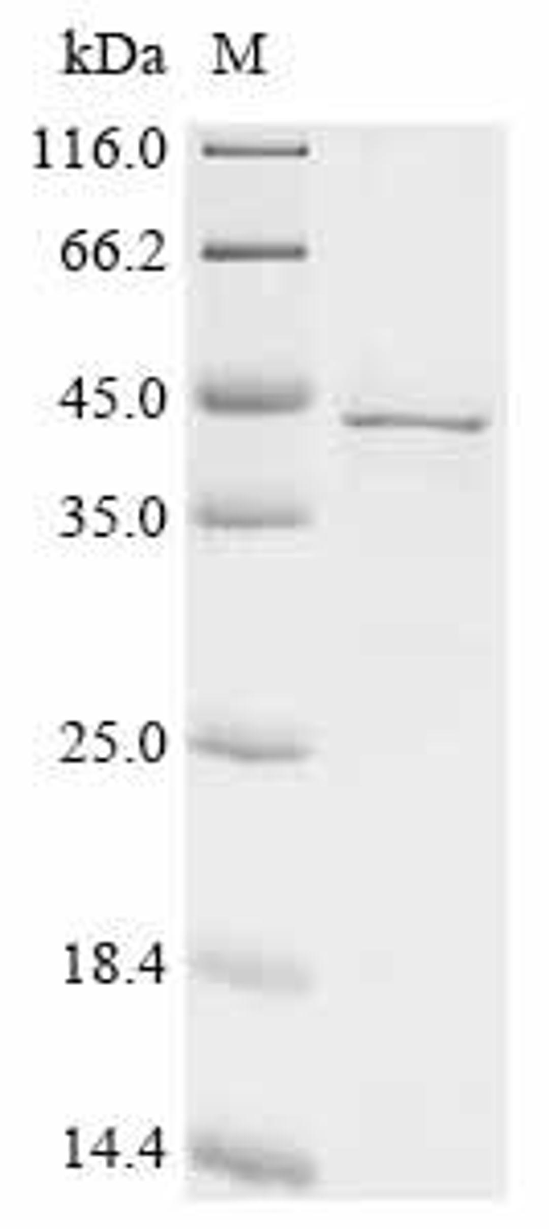 (Tris-Glycine gel) Discontinuous SDS-PAGE (reduced) with 5% enrichment gel and 15% separation gel.