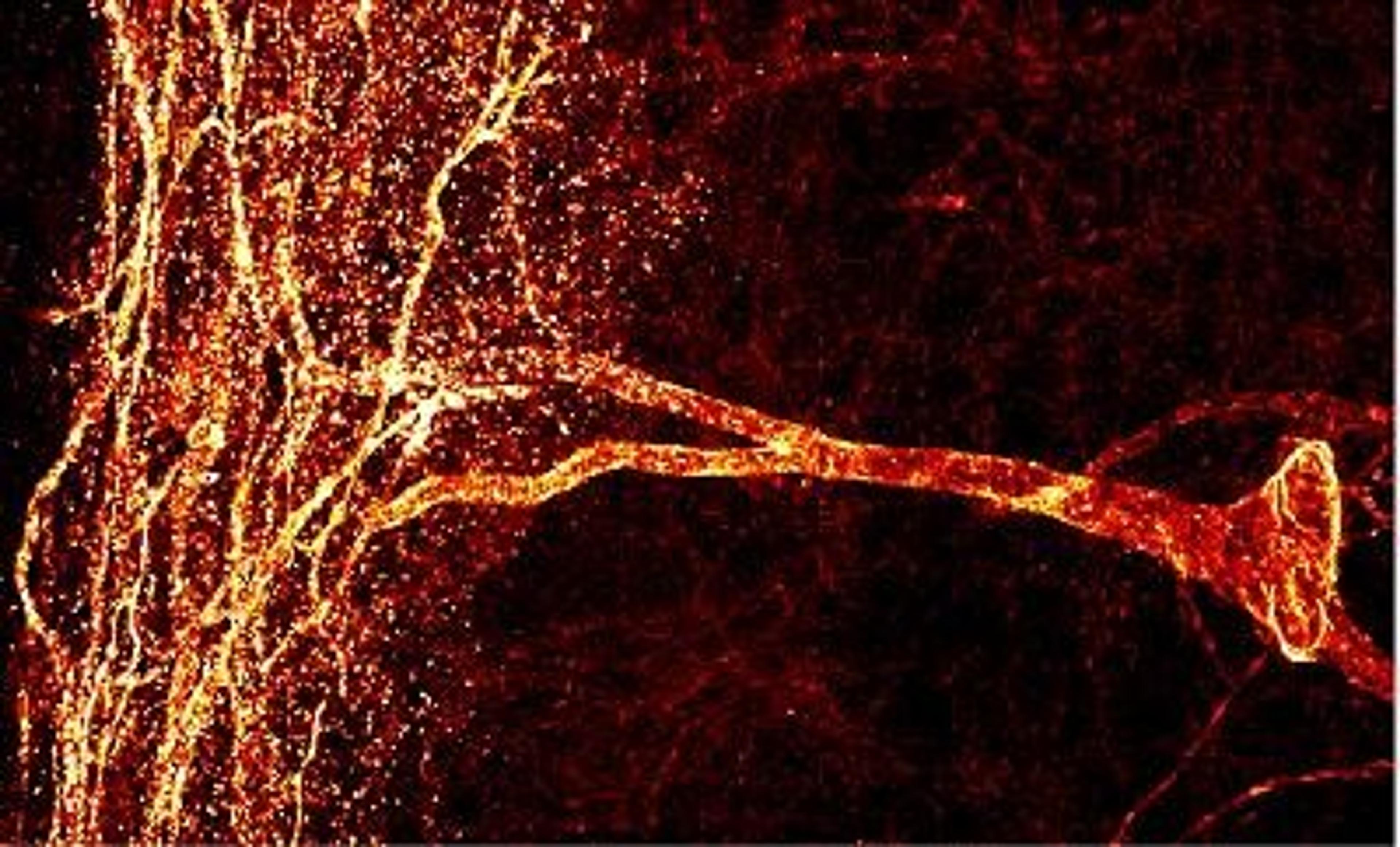 Immunocytochemistry/Immunofluorescence: Neurokinin 1 Receptor Antibody [NB300-101] - Confocal image of SPR reactivity using polyclonal anti-NK-1 Receptor (NB 300-101) in a lamina III neuron in the spinal cord of a rat.