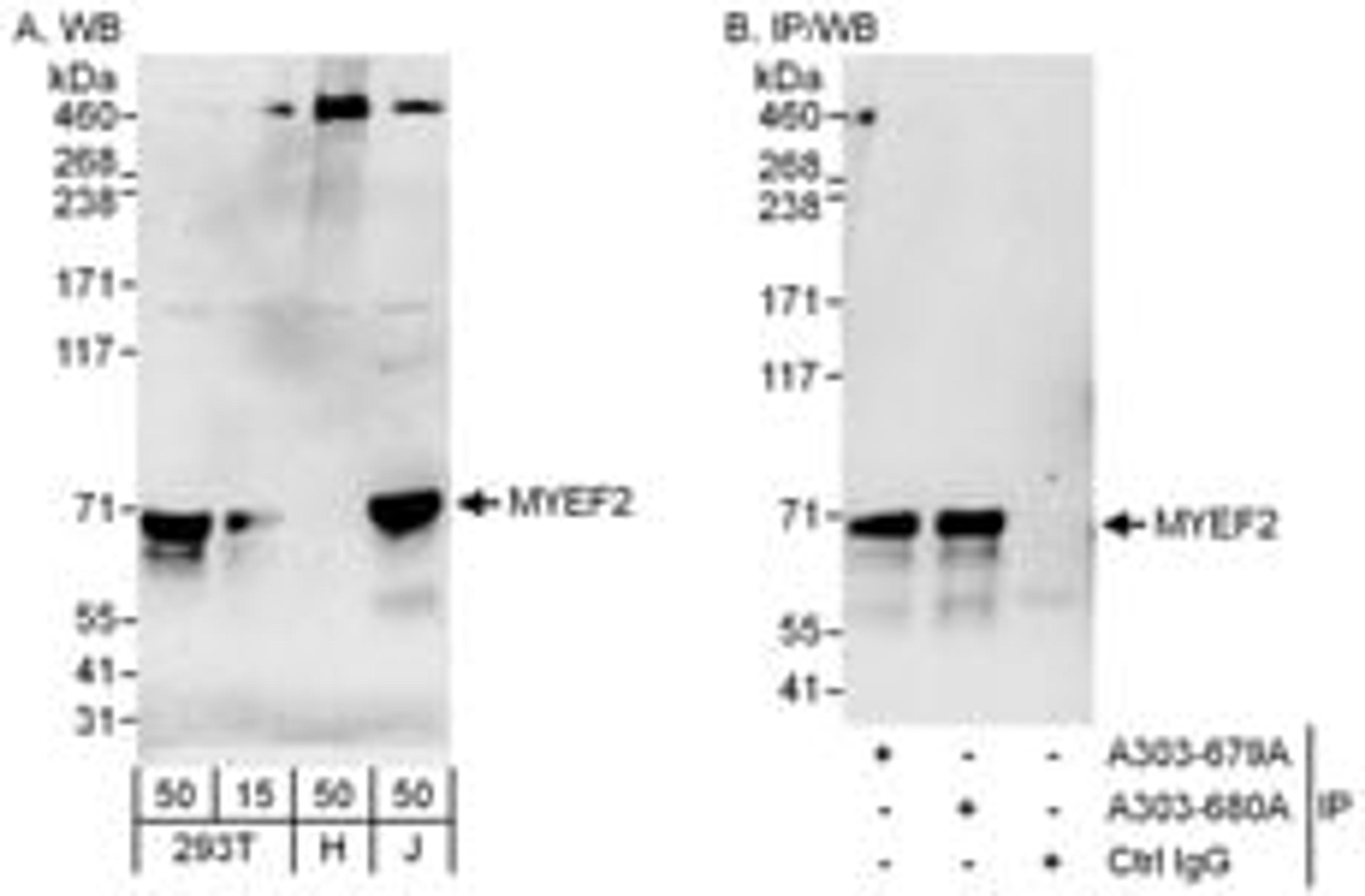 Detection of human MYEF2 by western blot and immunoprecipitation.