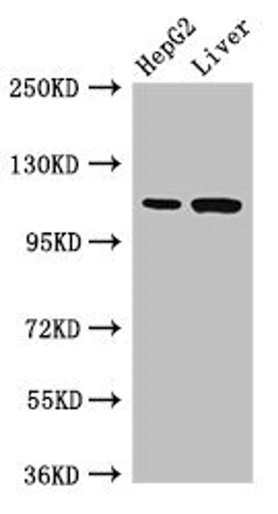 Western Blot. Positive WB detected in: HepG2 whole cell lysate, Rat liver tissue. All lanes: Tmprss15 antibody at 3ug/ml. Secondary. Goat polyclonal to rabbit IgG at 1/50000 dilution. Predicted band size: 119 kDa. Observed band size: 119 kDa.