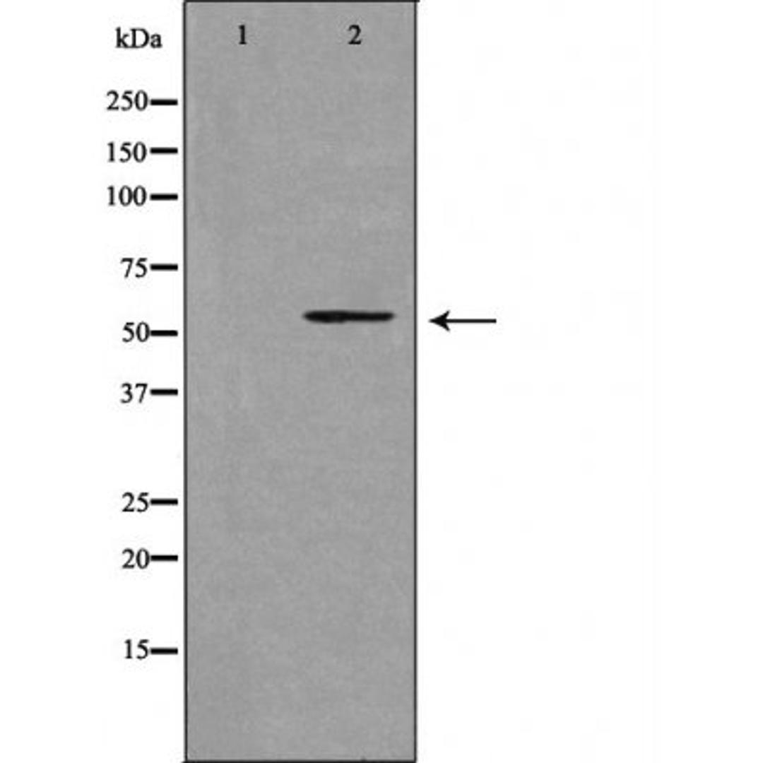 Western blot analysis of LOVO cells and HUVEC cells using 39A1 (Cytochrome P450) antibody