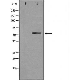 Western blot analysis of LOVO cells and HUVEC cells using 39A1 (Cytochrome P450) antibody