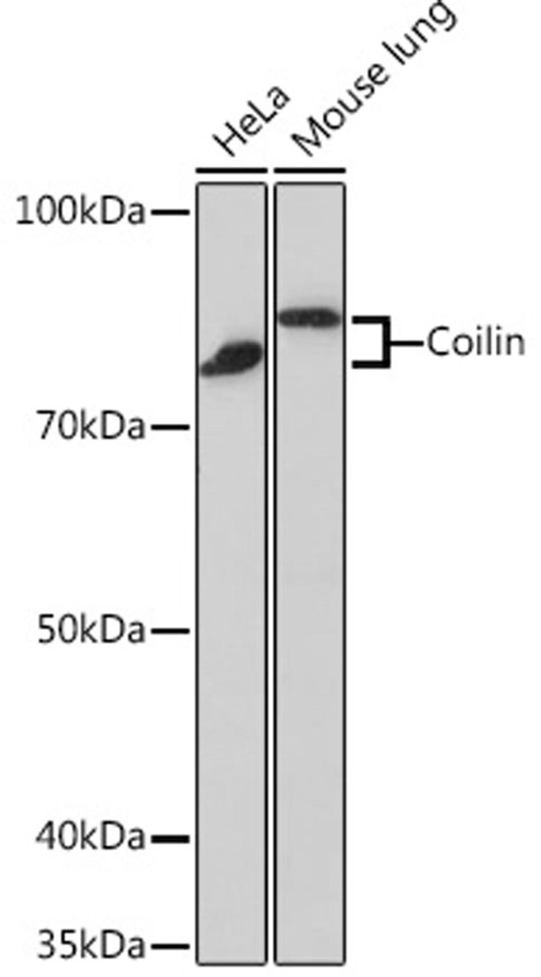 Western blot - Coilin Rabbit mAb (A3483)