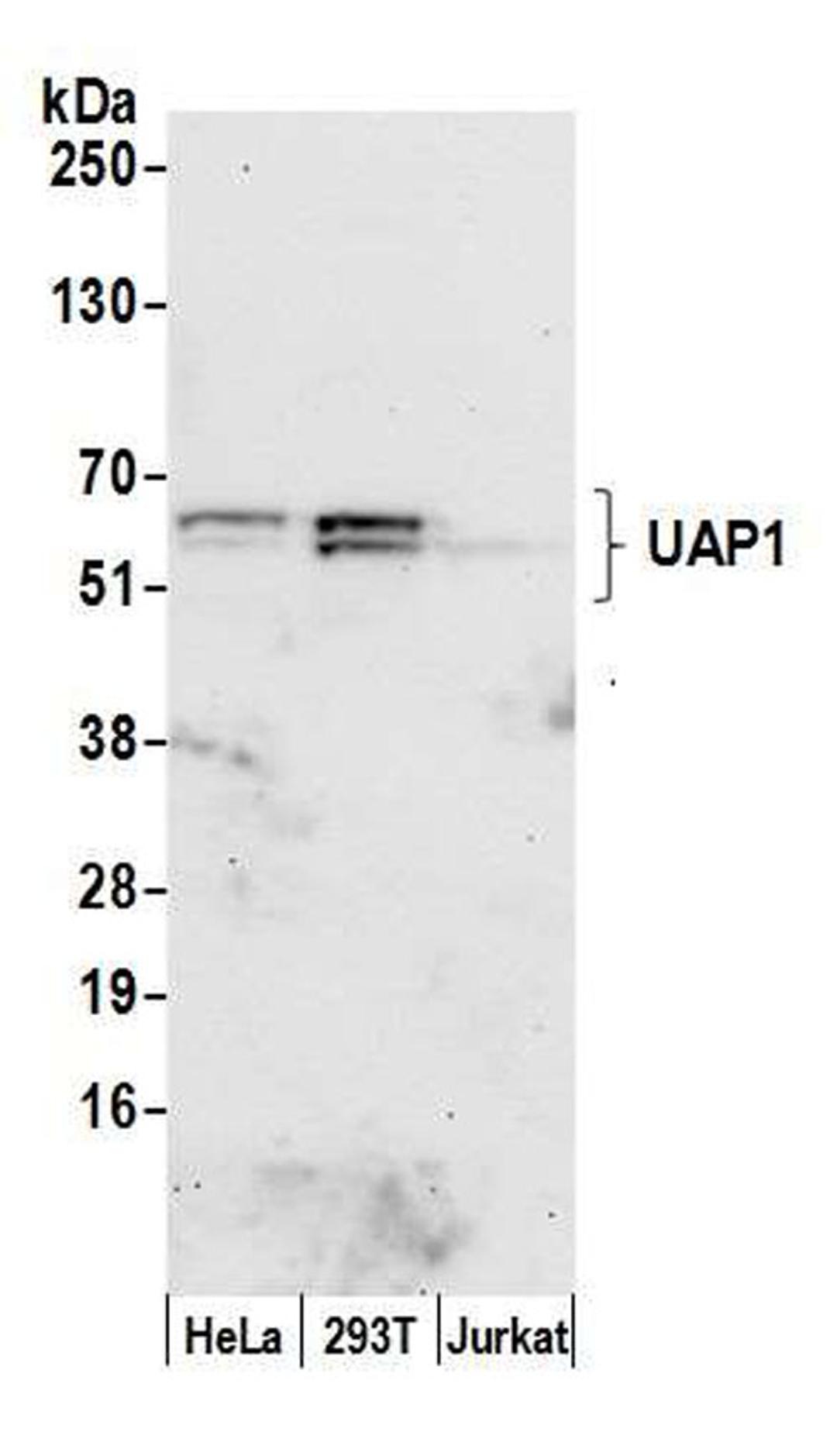 Detection of human UAP1 by WB.