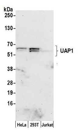 Detection of human UAP1 by WB.