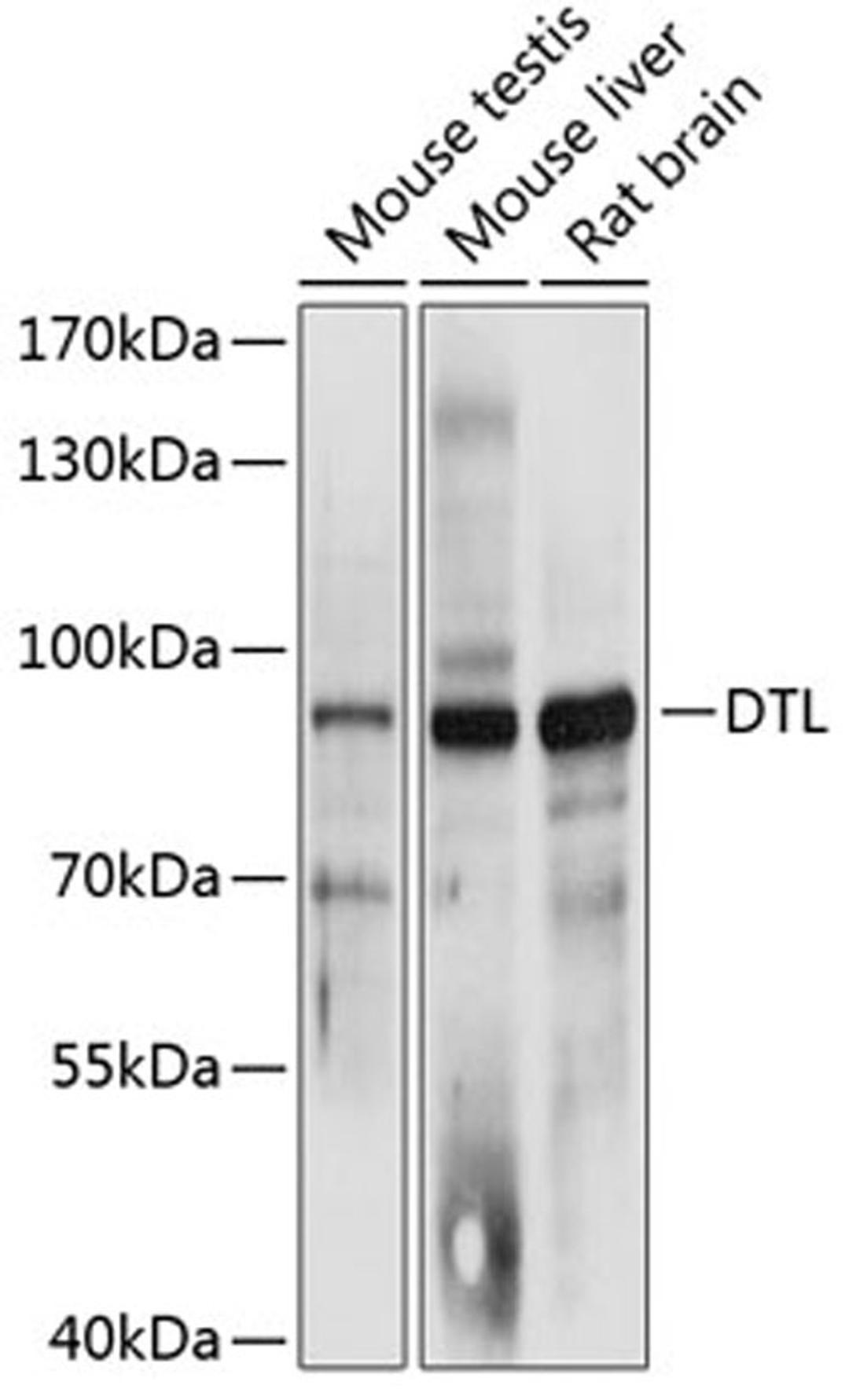 Western blot - DTL antibody (A12150)