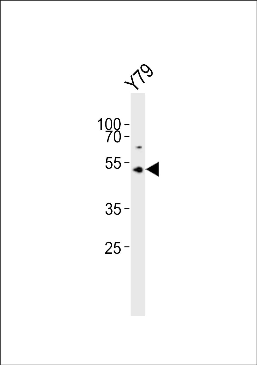 Western blot analysis of lysate from Y79 cell line, using ASMT Antibody at 1:1000.