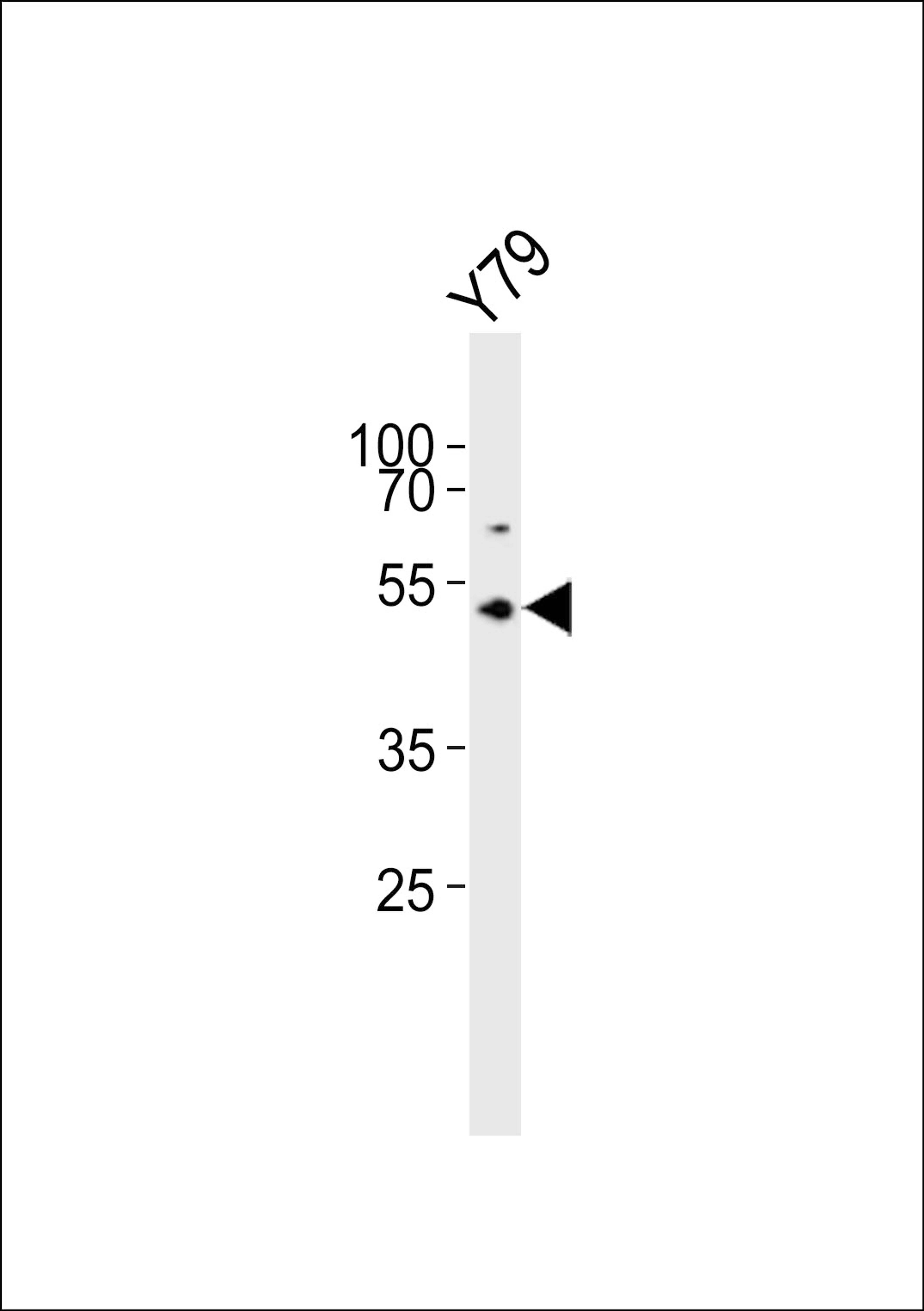 Western blot analysis of lysate from Y79 cell line, using ASMT Antibody at 1:1000.