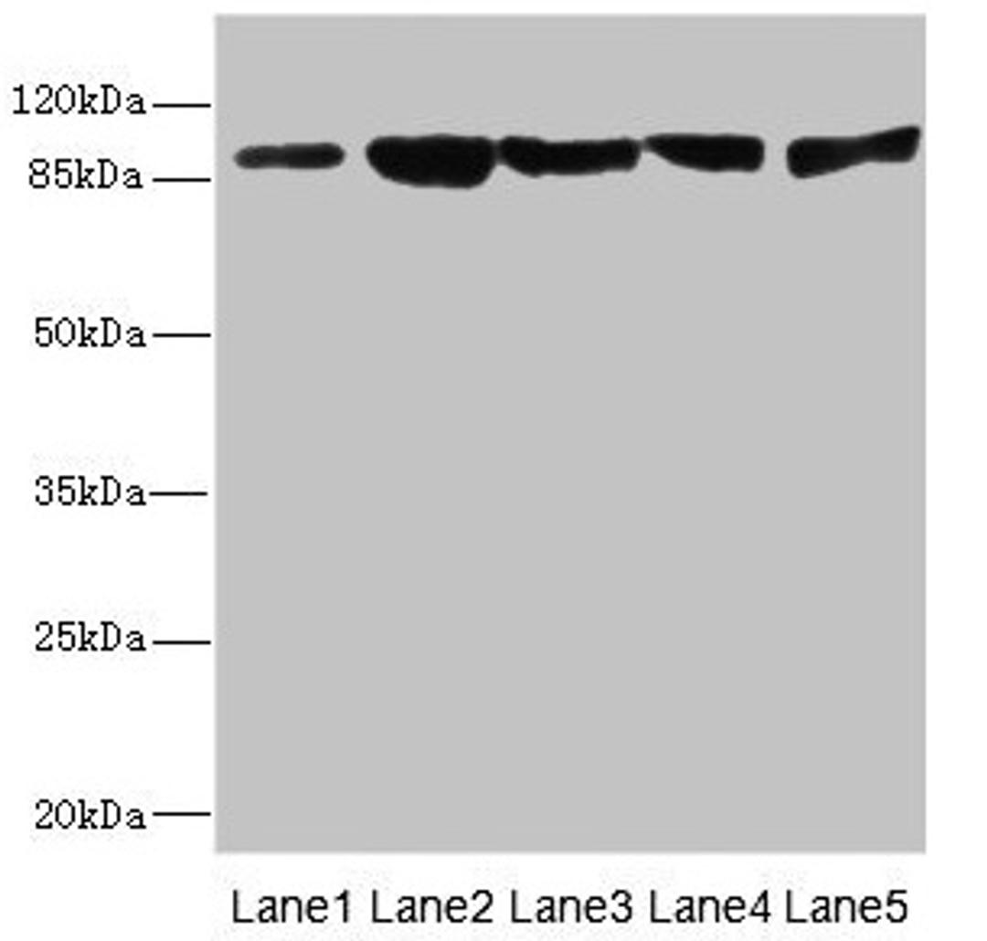 Western blot. All lanes: DSC2 antibody at 3.46µg/ml. Lane 1: Rat heart tissue. Lane 2: A549 whole cell lysate. Lane 3: HepG2 whole cell lysate. Lane 4: Jurkat whole cell lysate. Lane 5: 293T whole cell lysate. Secondary. Goat polyclonal to rabbit IgG at 1/10000 dilution. Predicted band size: 100, 94 kDa. Observed band size: 94 kDa