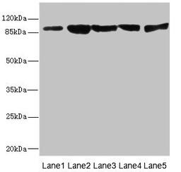 Western blot. All lanes: DSC2 antibody at 3.46µg/ml. Lane 1: Rat heart tissue. Lane 2: A549 whole cell lysate. Lane 3: HepG2 whole cell lysate. Lane 4: Jurkat whole cell lysate. Lane 5: 293T whole cell lysate. Secondary. Goat polyclonal to rabbit IgG at 1/10000 dilution. Predicted band size: 100, 94 kDa. Observed band size: 94 kDa