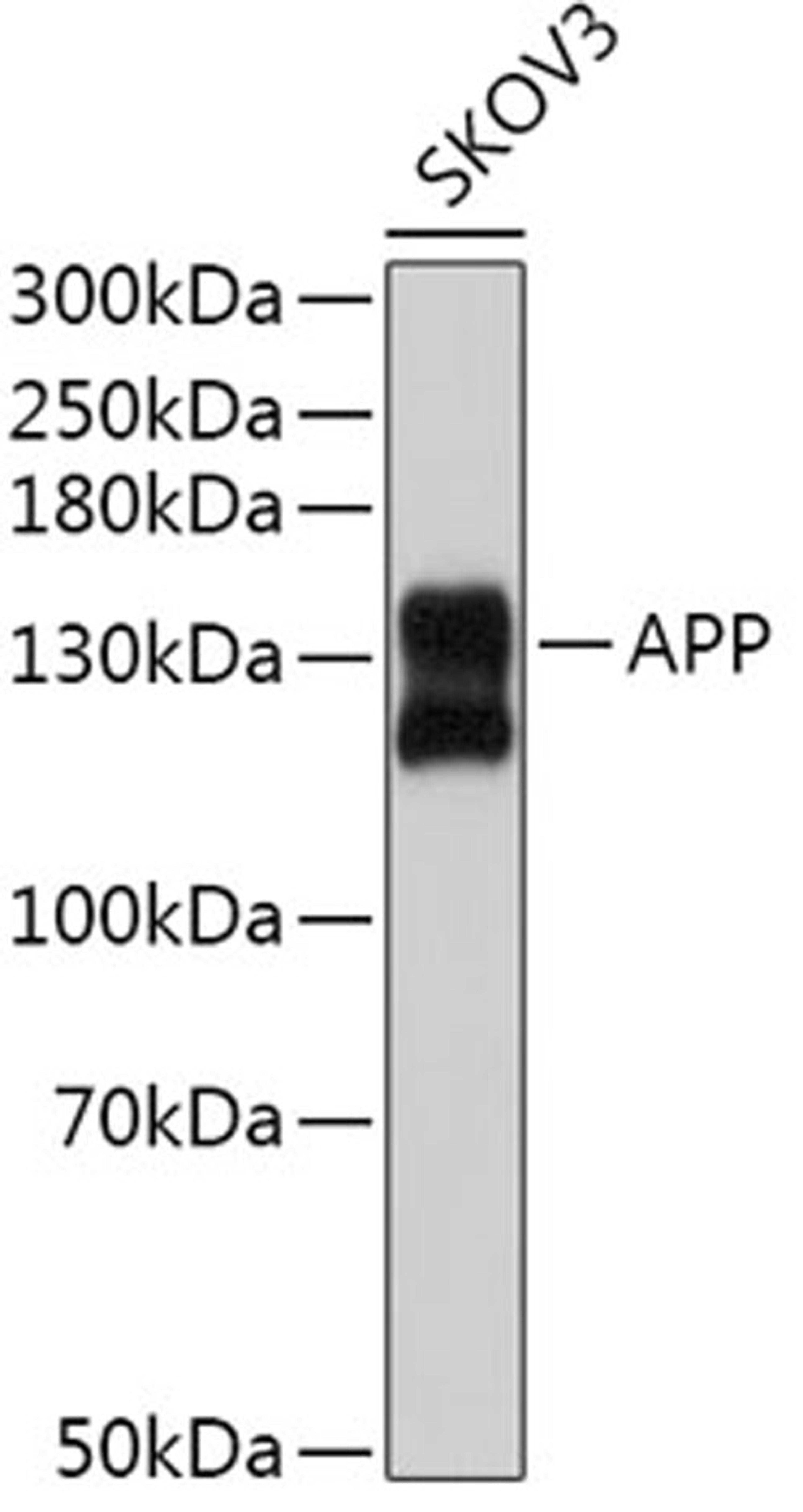 Western blot - APP antibody (A3161)