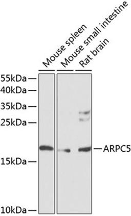 Western blot - ARPC5 antibody (A8571)