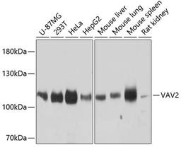 Western blot - VAV2 antibody (A9483)