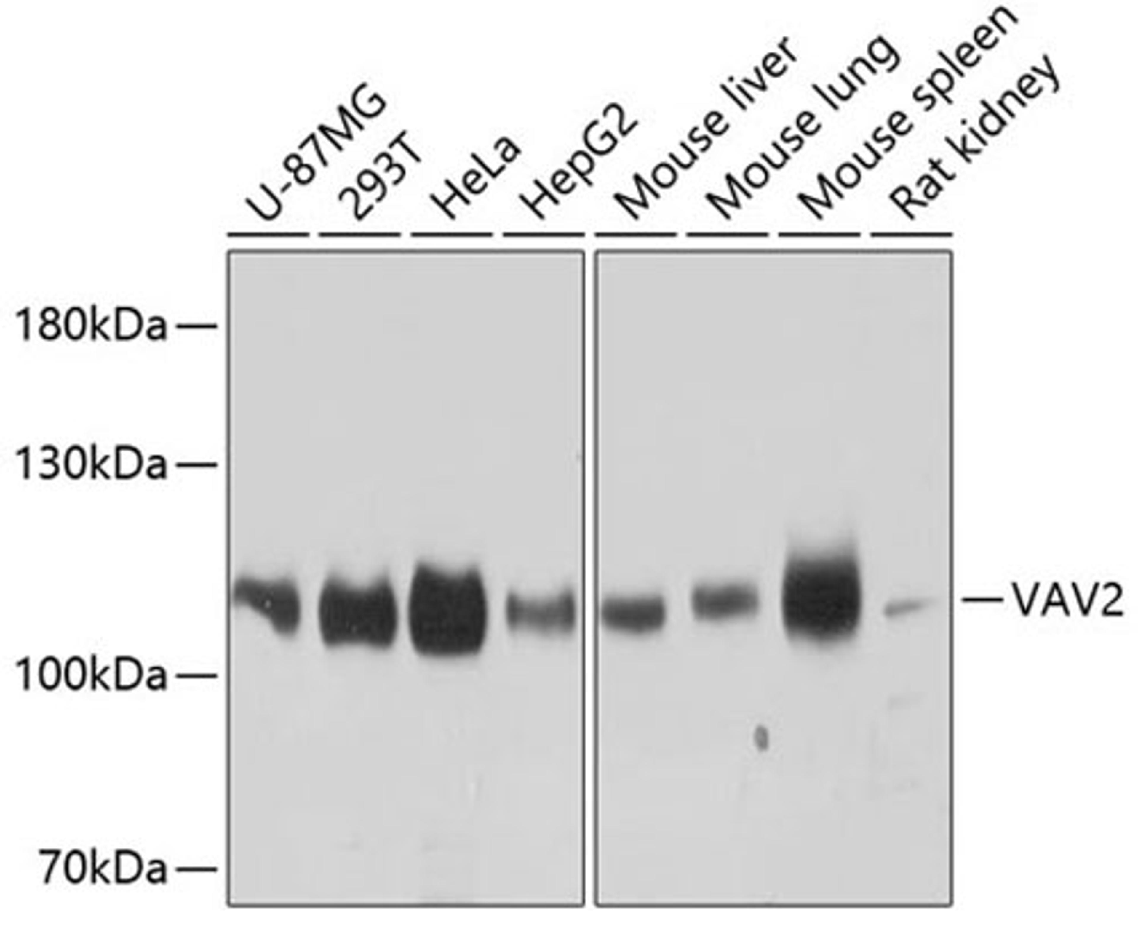 Western blot - VAV2 antibody (A9483)