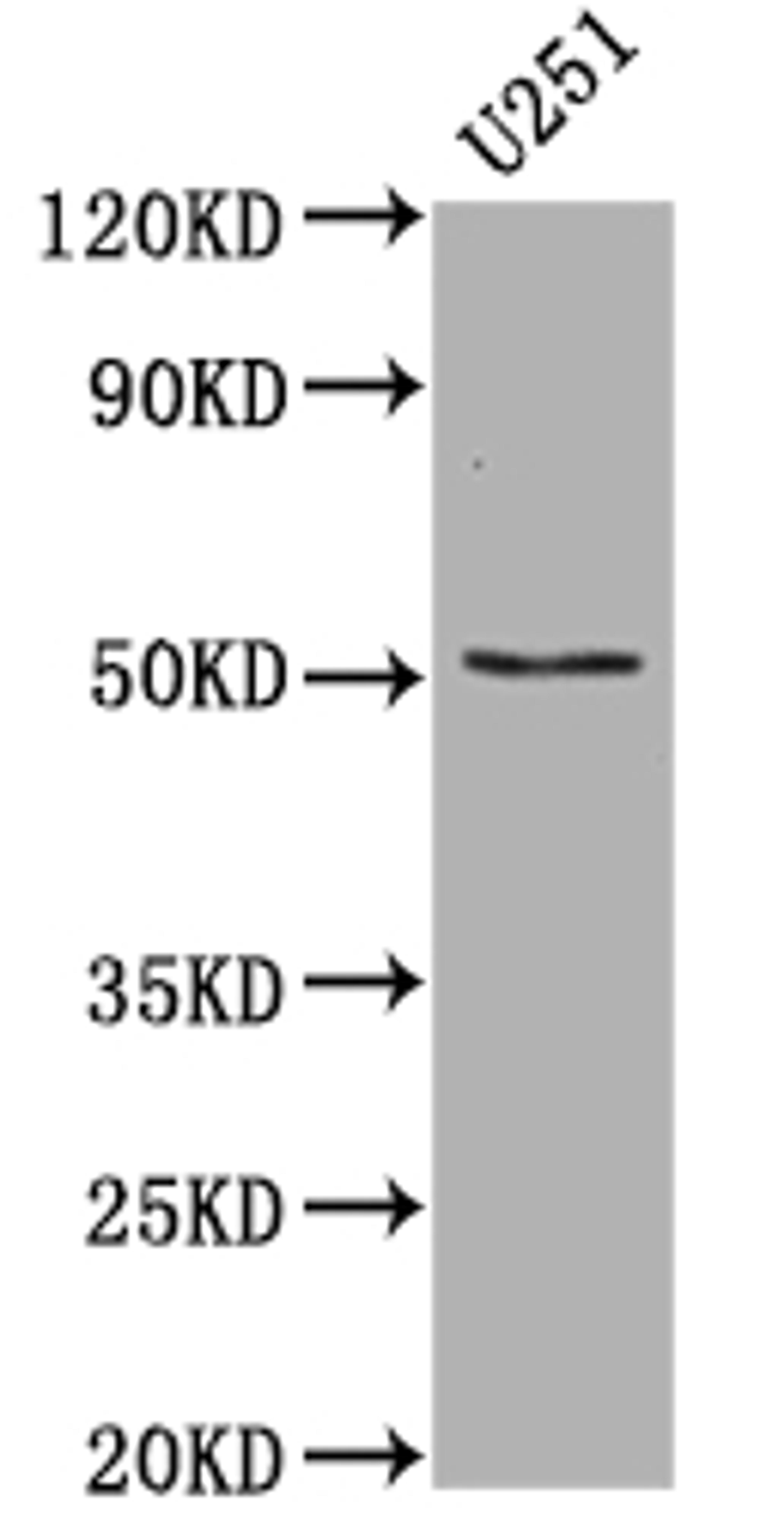 Western Blot. Positive WB detected in: U-251 whole cell lysate. All lanes: Mutant p53 antibody at 1:1000. Secondary. Goat polyclonal to rabbit IgG at 1/50000 dilution. Predicted band size: 38, 39, 40, 34, 35, 30, 24, 25 kDa. Observed band size: 53 kDa. 