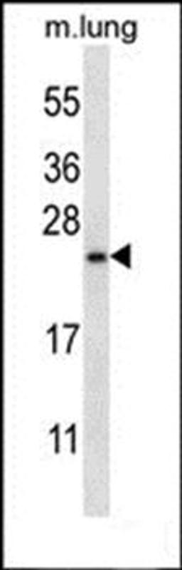 Western blot analysis of mouse lung tissue lysates (35ug/lane)using RHEBL1 antibody (primary antibody dilution at: 1:1000)