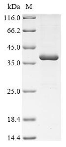 (Tris-Glycine gel) Discontinuous SDS-PAGE (reduced) with 5% enrichment gel and 15% separation gel.