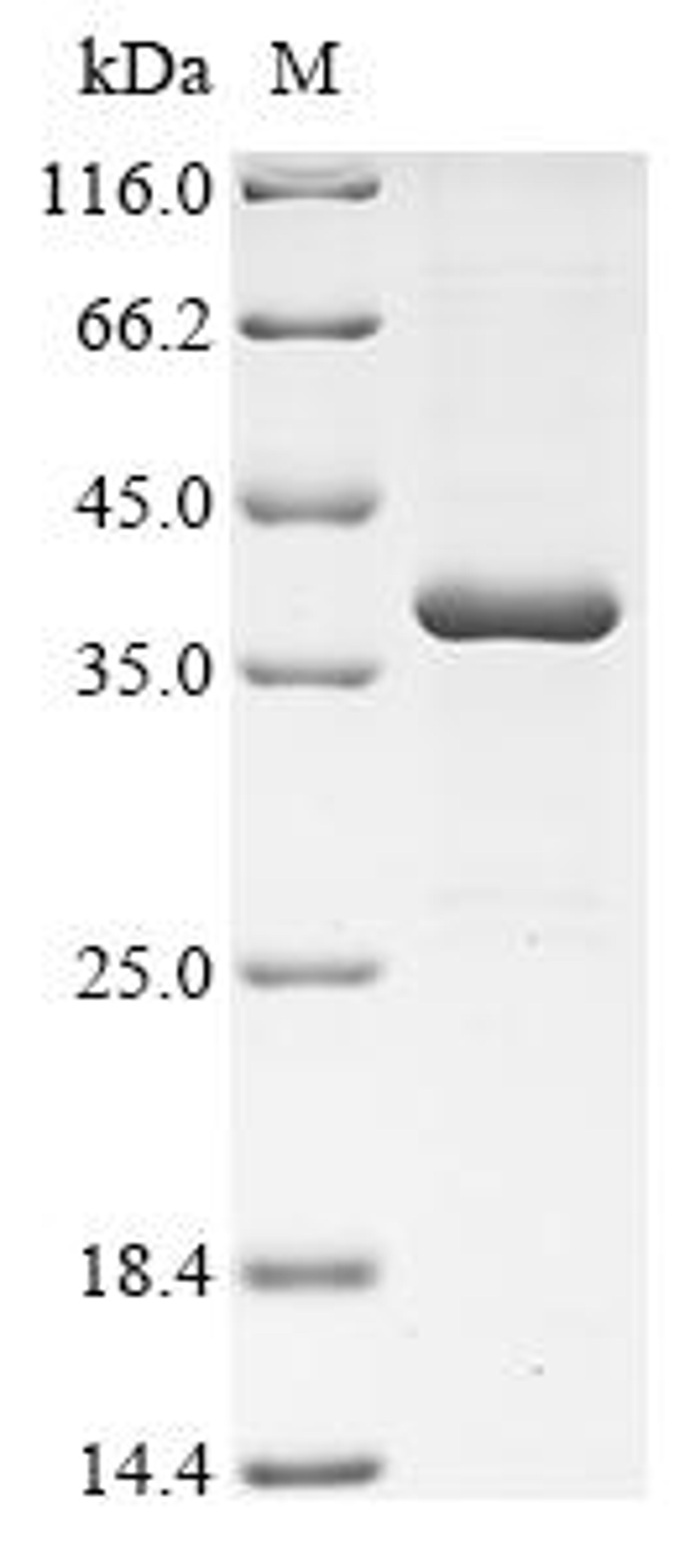 (Tris-Glycine gel) Discontinuous SDS-PAGE (reduced) with 5% enrichment gel and 15% separation gel.
