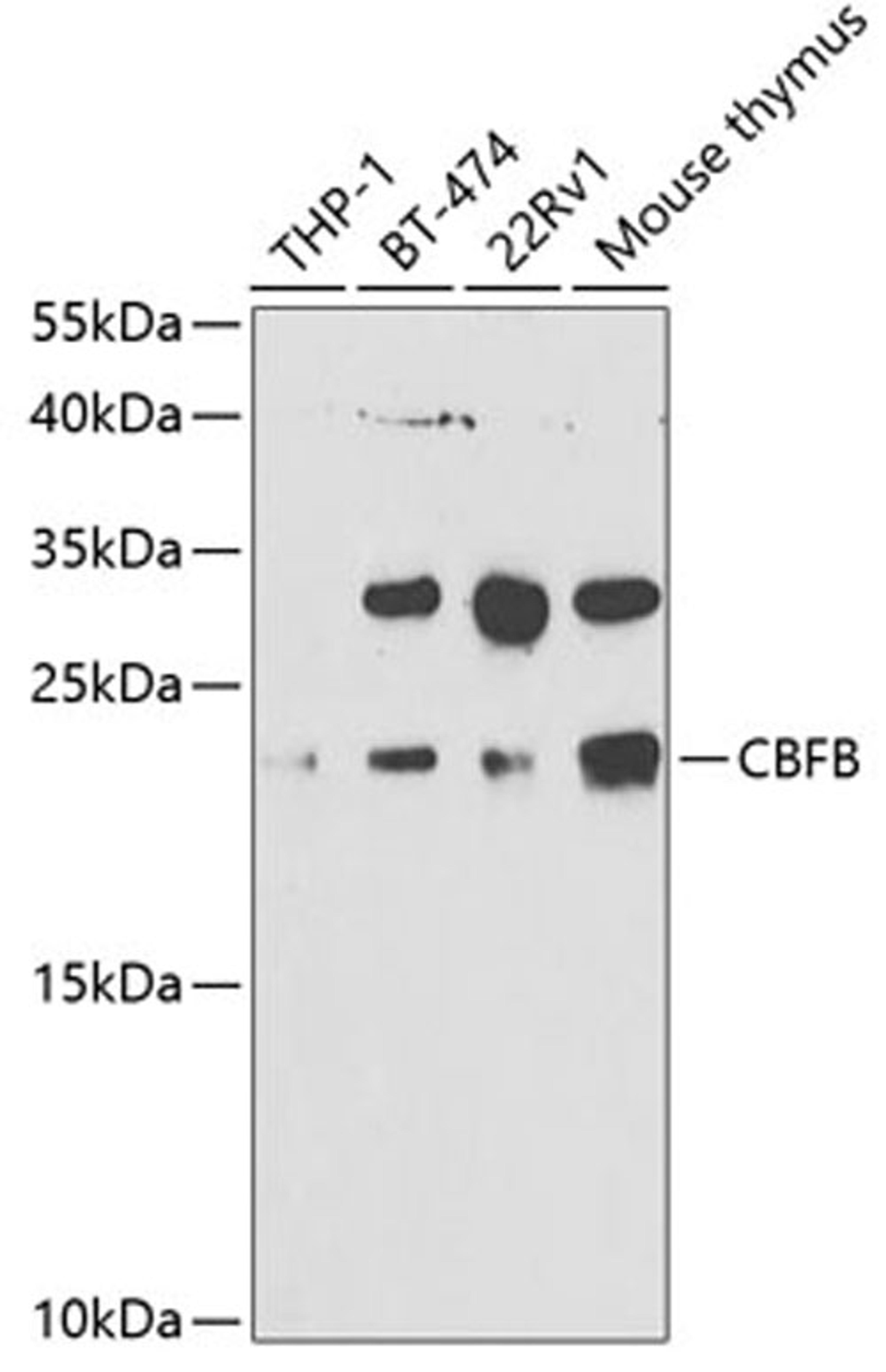 Western blot - CBFB antibody (A5305)