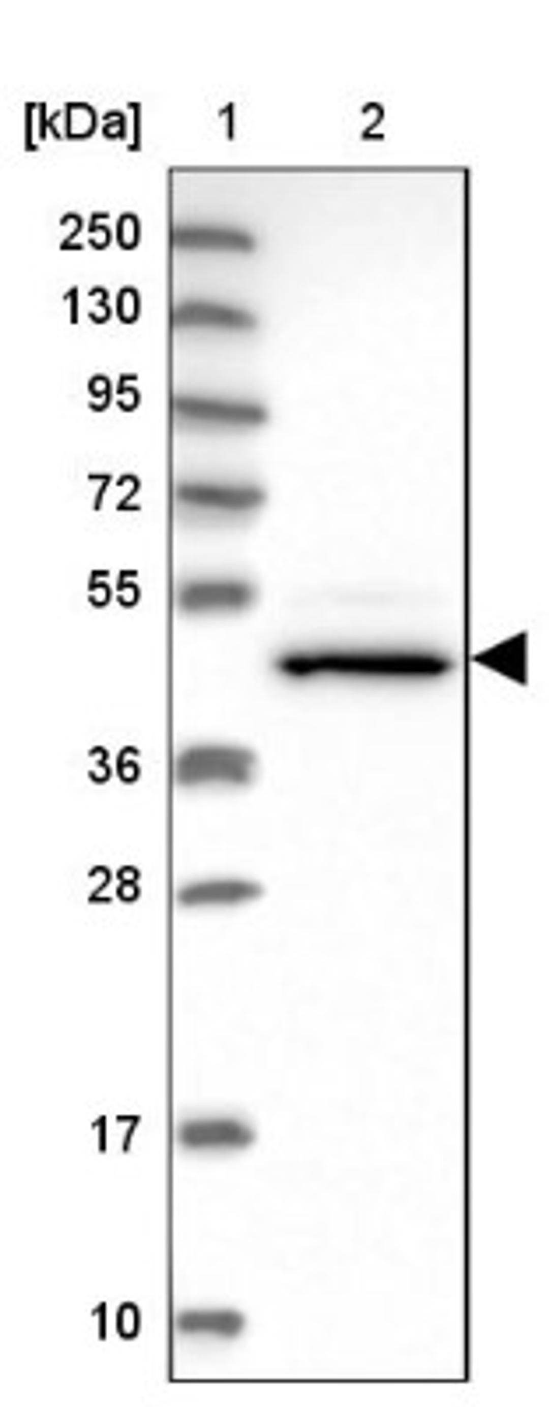 Western Blot: CHST12 Antibody [NBP1-91784] - Lane 1: Marker [kDa] 250, 130, 95, 72, 55, 36, 28, 17, 10<br/>Lane 2: Human cell line RT-4