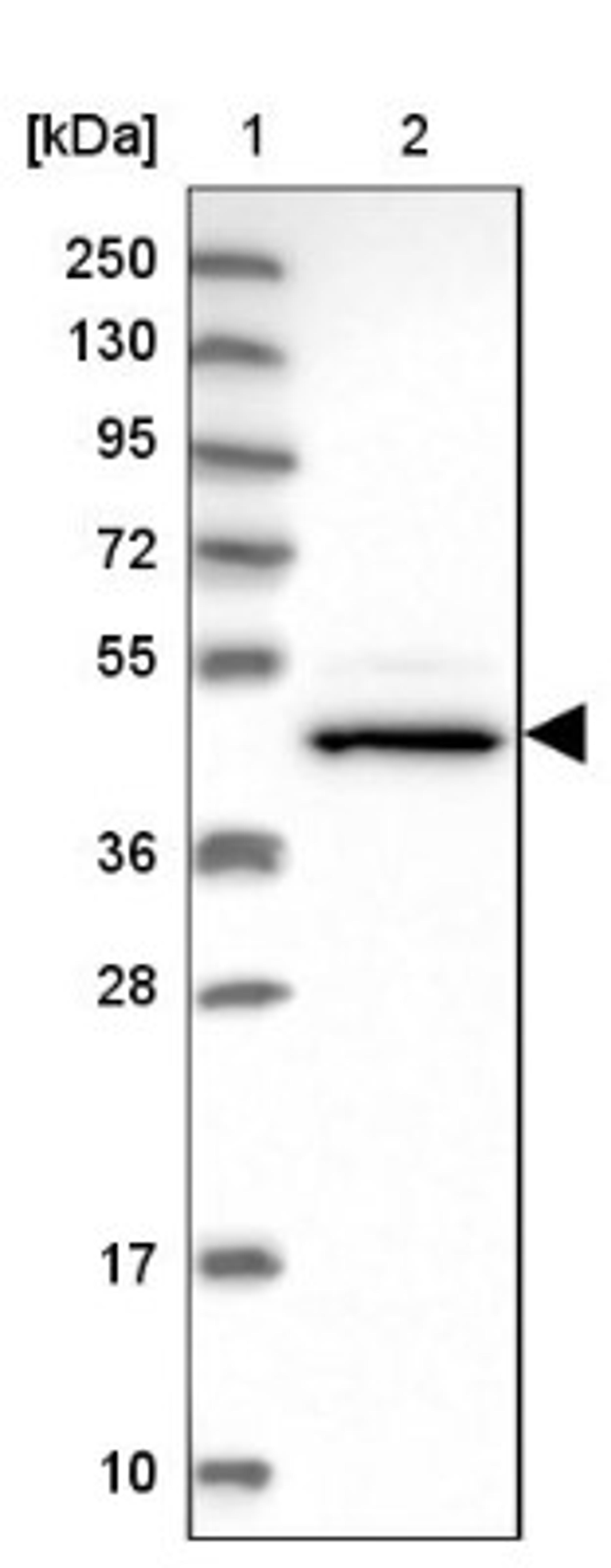 Western Blot: CHST12 Antibody [NBP1-91784] - Lane 1: Marker [kDa] 250, 130, 95, 72, 55, 36, 28, 17, 10<br/>Lane 2: Human cell line RT-4