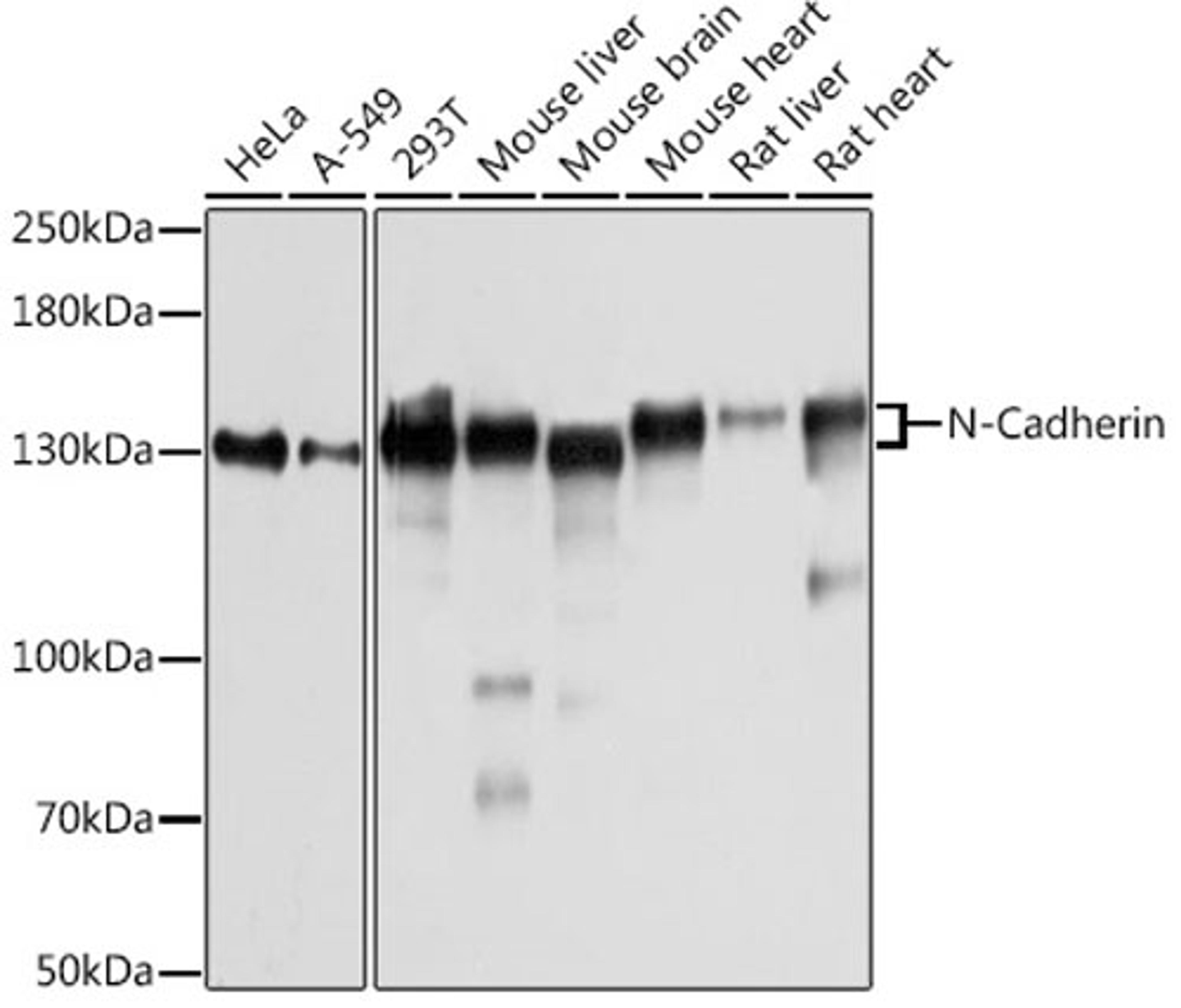 Western blot - N-Cadherin antibody (A3045)