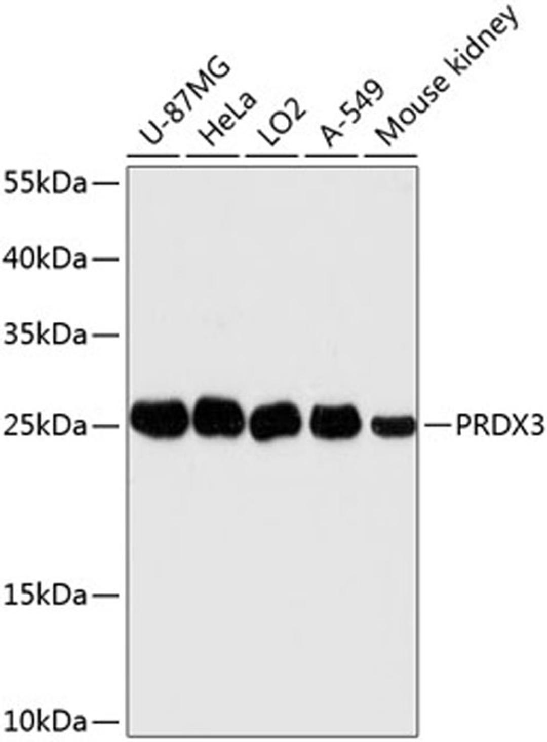 Western blot - PRDX3 antibody (A13074)