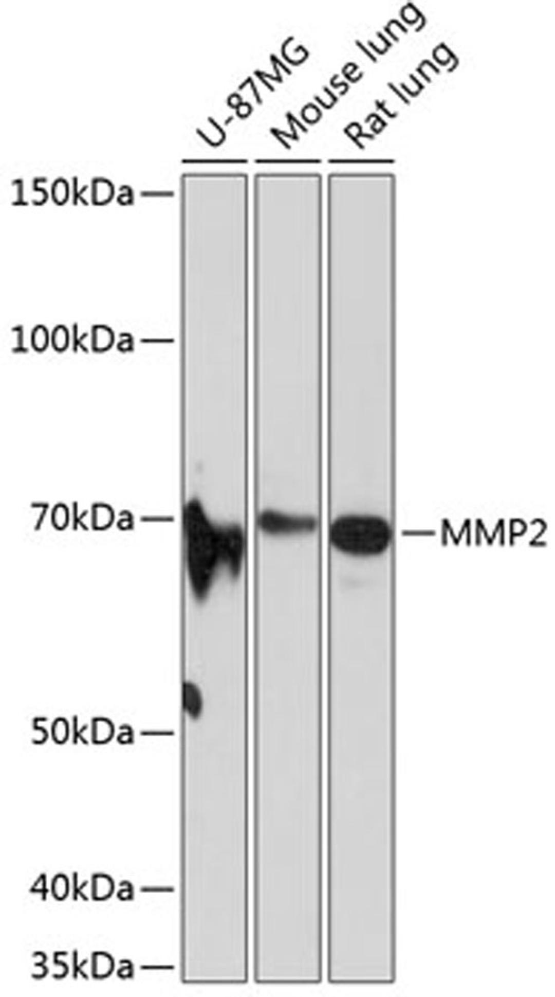 Western blot - MMP2 antibody (A19080)