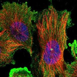 Immunocytochemistry/Immunofluorescence: DIS3L Antibody [NBP1-81941] - Staining of human cell line U-251 MG shows positivity in plasma membrane, cytoplasm & centrosome.