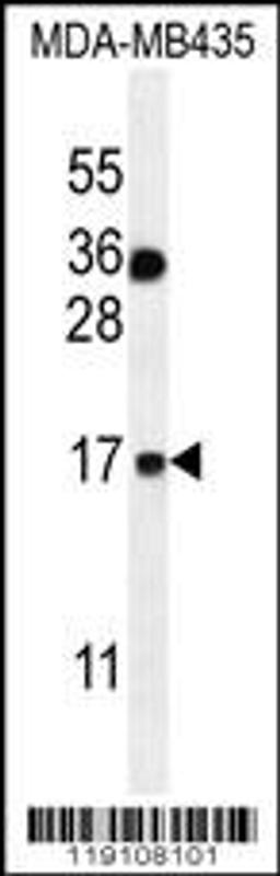 Western blot analysis in MDA-MB435 cell line lysates (35ug/lane).